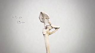 Total Hip Replacement By Dr Andrew Yun