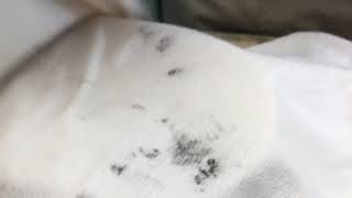 綿ワンピースアイライナーシミ抜き 【アイライナーシミ抜きクリーニング】 宅配クリーニング せんたく屋太郎