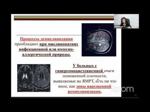Миелин и миелинопатии