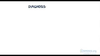 Acute Respiratory Distress Syndrome( ARDS) its causes and Diagnosis by osmosis