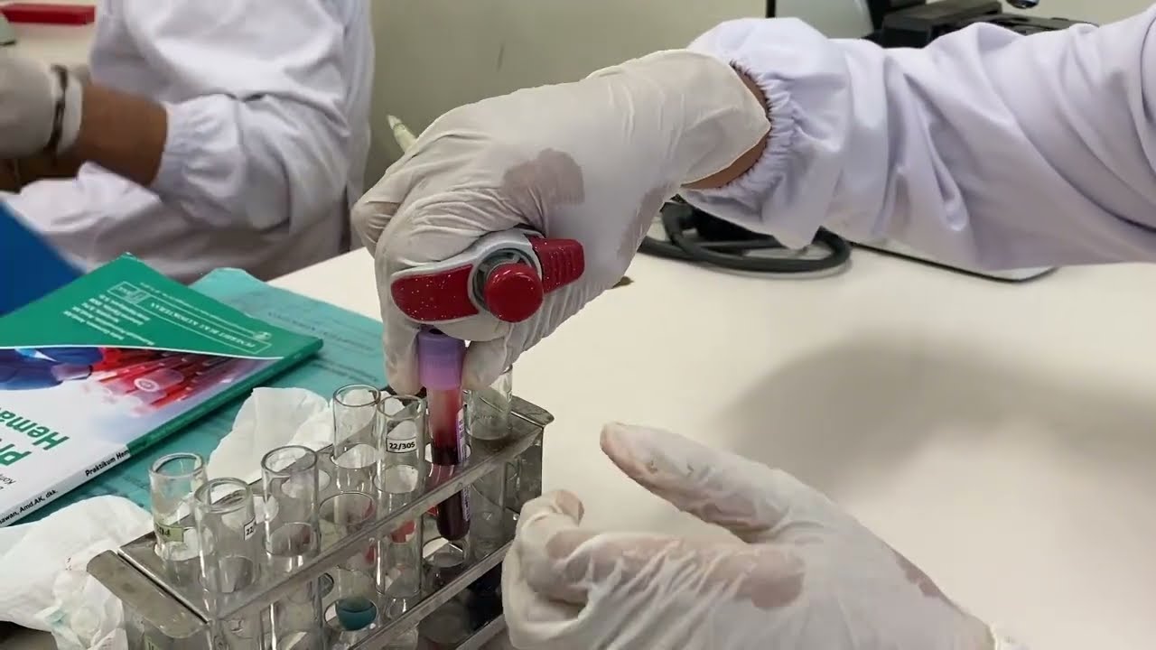 Pemeriksaan Hitung Jumlah Trombosit Metode Tabung