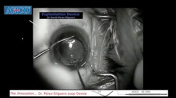 IOL Cutters - Perez Loop