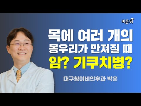 목에 여러 개의 몽우리가 만져질 때, 암? 기쿠치병? / 대구참이비인후과 박훈