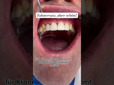 Schöne Zähne durch