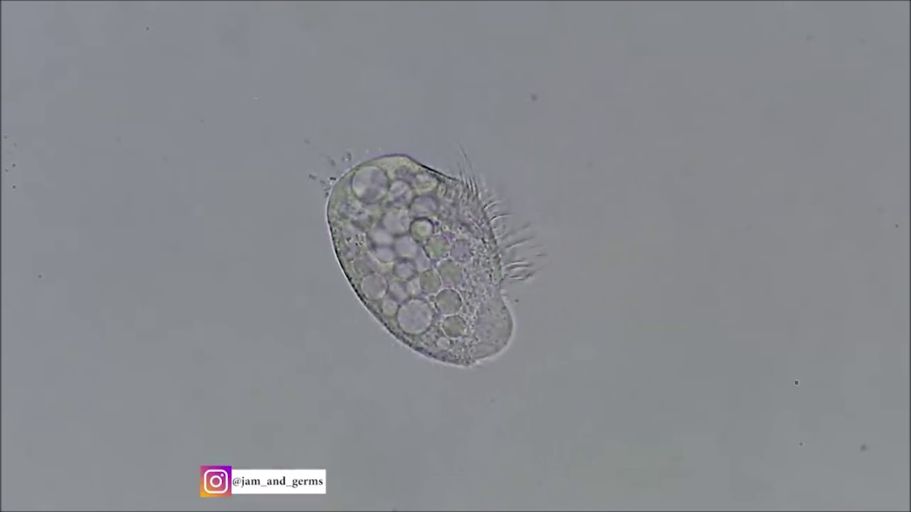 Single celled Organism Dies with Linkin Park music