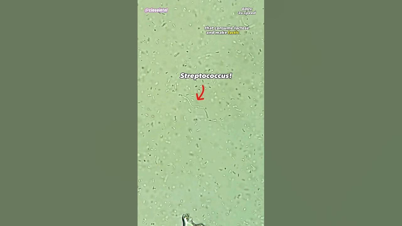 Yogurt Starter Culture Under Microscope YouTube