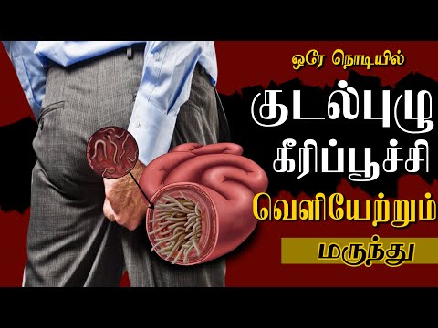 குடல் புழு | கீரிப்பூச்சி தீர்வுகள் என்ன ?ஒரே நொடியில் வெளியேற்றும் மருந்து