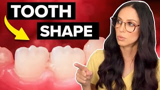 What Does This Tooth Shape Mean!? (Mamelons Explained)