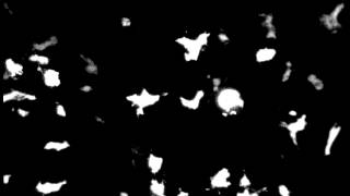 TIRF Movie of cytosolic-GFP Dicties