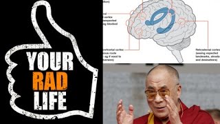 Famous Brain Games: YRL Interviews Clinical Neuropsychologist Dr.Robert Bilder at UCLA Wealth