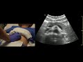 Abdominal Aorta and Pancreas Ultrasound Scanning Technique