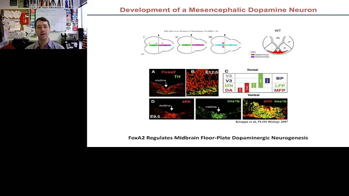 Dustin Wakeman   Advancing PD Cell Therapy Transplanting Cryopreserved iPSC derived Neurons