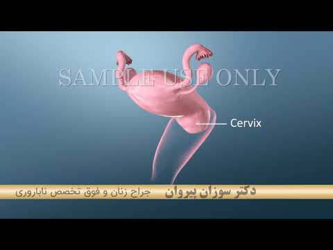 غربالگری سرطان دهانه رحم متخصص زنان و زایمان دکتر سوزان پیروان   