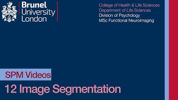 SPM Tutorial 12 - Image Segmentation