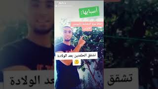 علاج تشقق حلمات الثدي #الدكتور_حسام