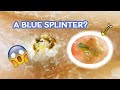 How to Remove a (Blue?) Splinter in a Pinkie Finger! An educational video!