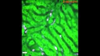 Molecular mechanisms of NET formation and degradation revealed by intravital imaging in the liver...