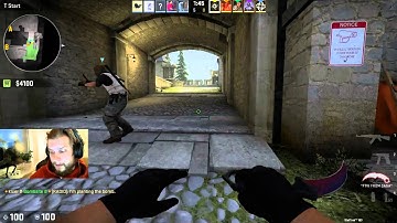 NiP F0rest about his config