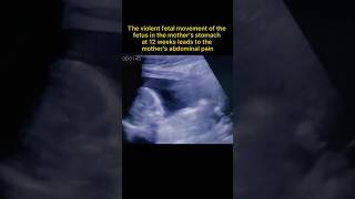 How Many Weeks Are You Pregnant?