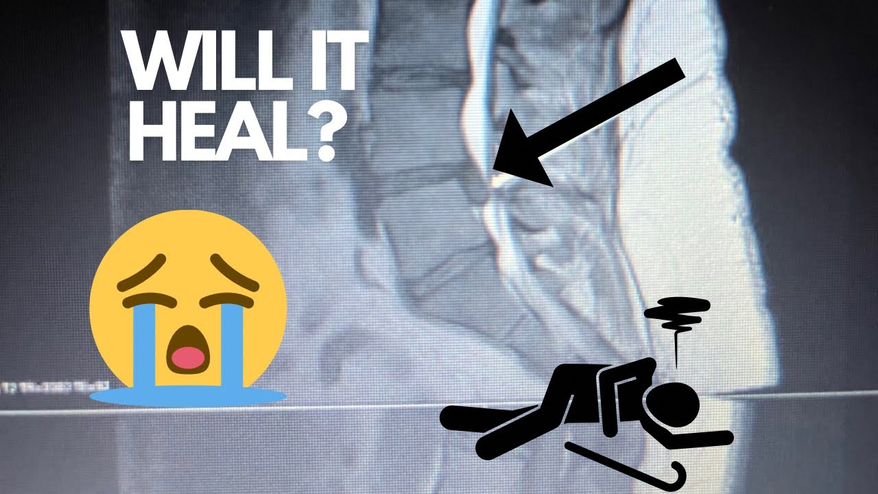 My battle with a herniated disc YouTube