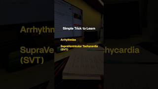 Simple trick to learn Arrhythmias || Supraventricular Tachycardia (SVT)