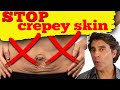 CREPEY SKIN SOLUTIONS // Tighten Loose Skin With These 6 Methods