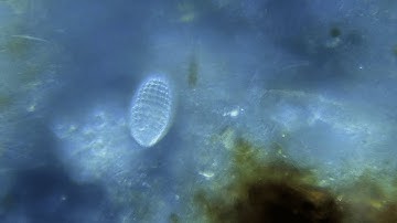 Coleps in 3D Darkfield for Inexpensive Microscopes (SW380B SW380T)