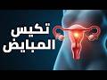 تكيس المبايض PCOS الأعراض والعلاج وتنظيم الدورة الشهرية 