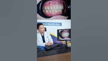 Tip giữ răng ổn định sau tháo niềng? Nha khoa Thành An