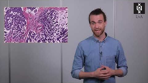 3MT pitch Yoni Schirris, AI for histopathological images: next step to personalised immunotherapy