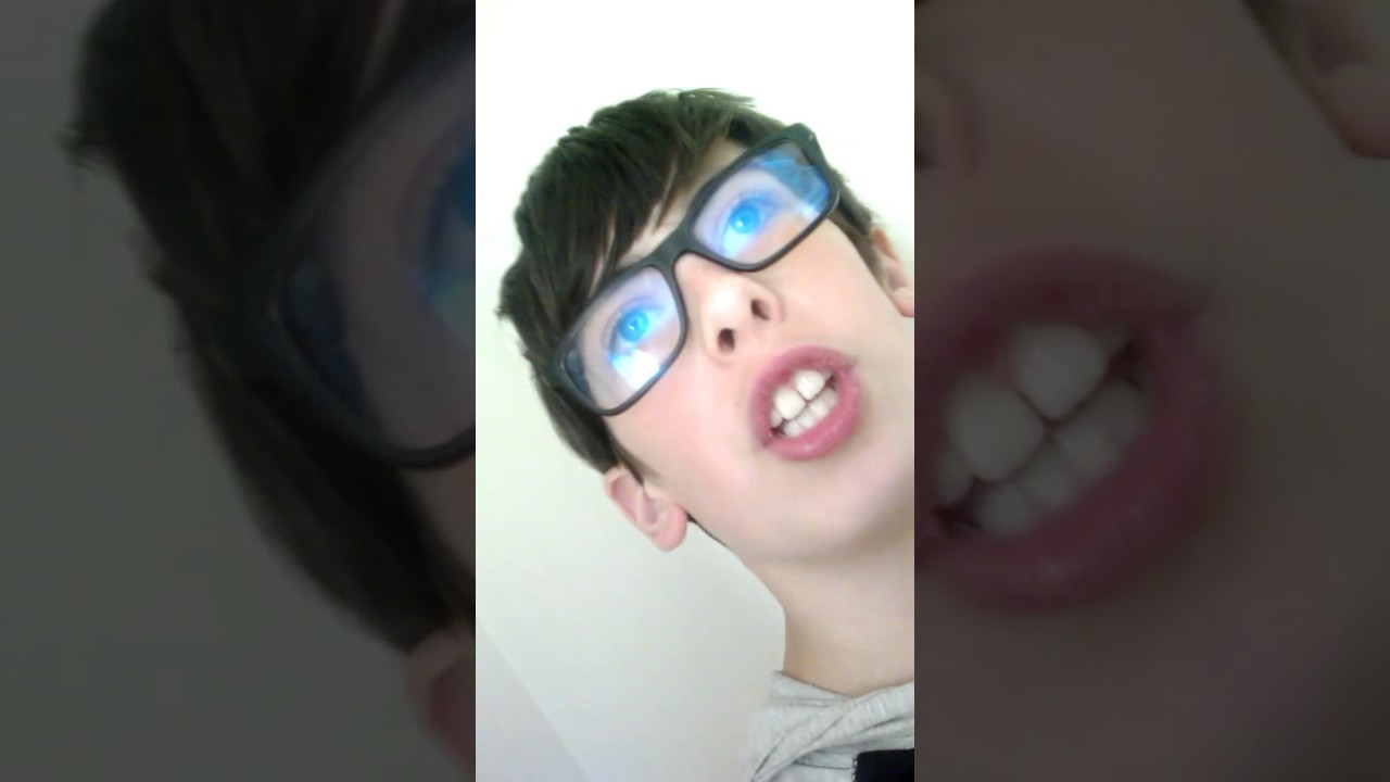 Roasting The Pro Wildseen