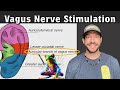 Electrical Vagus Nerve Stimulation To Improve Pelvic Health: Part 3