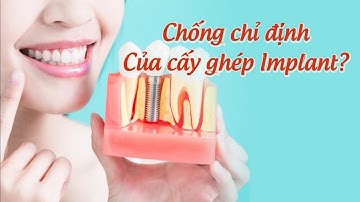 Chống chỉ định trong cấy ghép implant là gì? | Chống chỉ định trong trồng răng implant là gì?