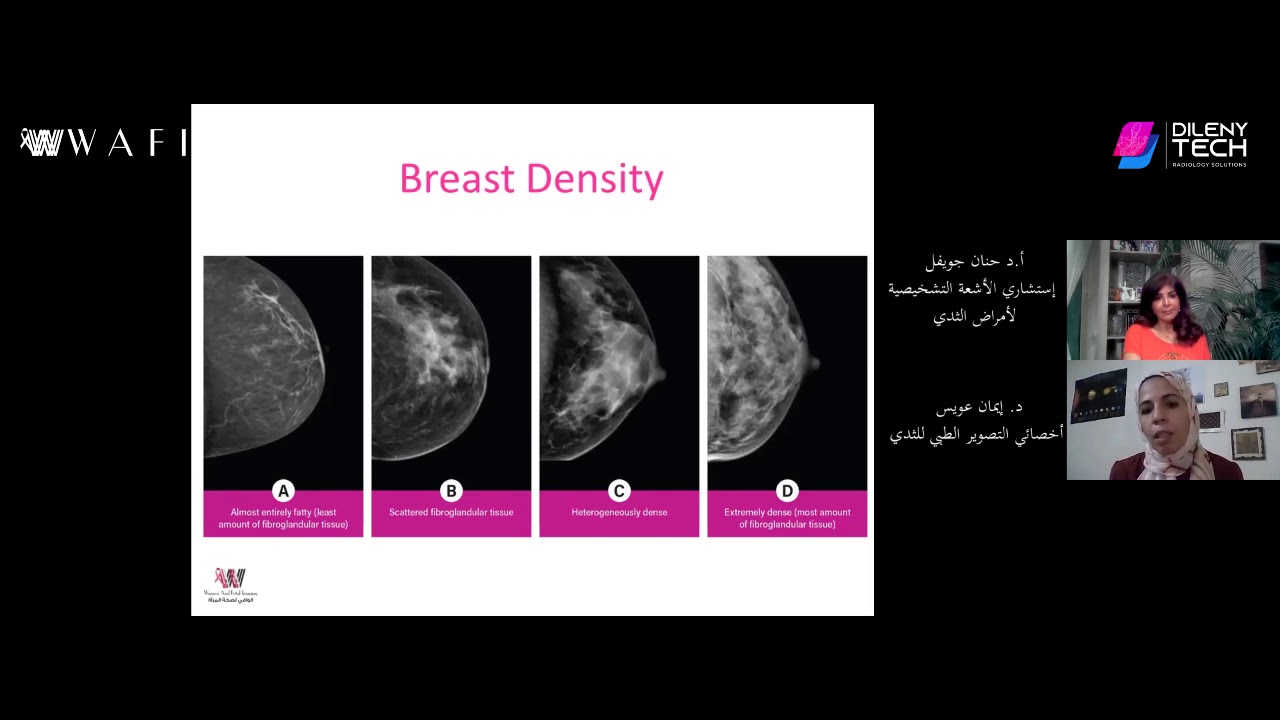 ما هي كثافة الثدي؟ وكيفية عمل أشعة الماموجرام | د إيمان عويس أخصائي التصوير الطبي للثدي