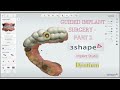 3shape implant studio:A step by step tutorial for immediate implant case ( Part 1 )