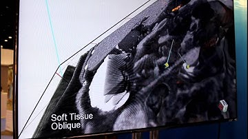 Digital ArtForms at RSNA 2011