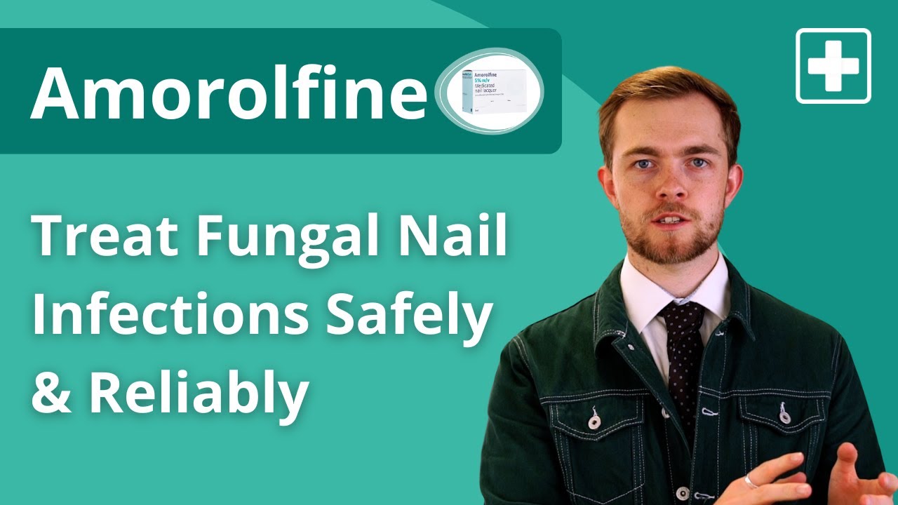 Amorolfine (Medicated Nail Lacquer) | Fungal Nail Treatment Guide