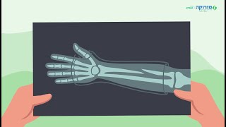 Animated explainer video for the Soroka Medical Center (Hebrew)