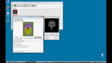 Watershed Segmentation