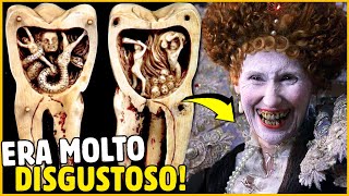 Perché I Denti Marci Avevano Tanto Successo Nel Passato?
