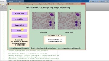 Matlab Code for RBC and WBC Detection