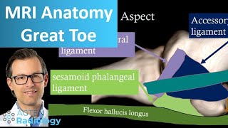 Great toe MRI Anatomy  First metatarsophalangeal joint