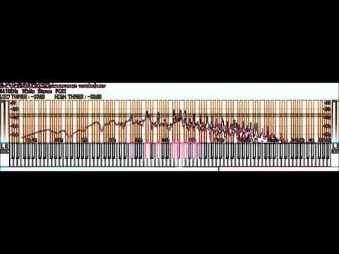 NGT48 みどりと森の運動公園(pianoarrange version)