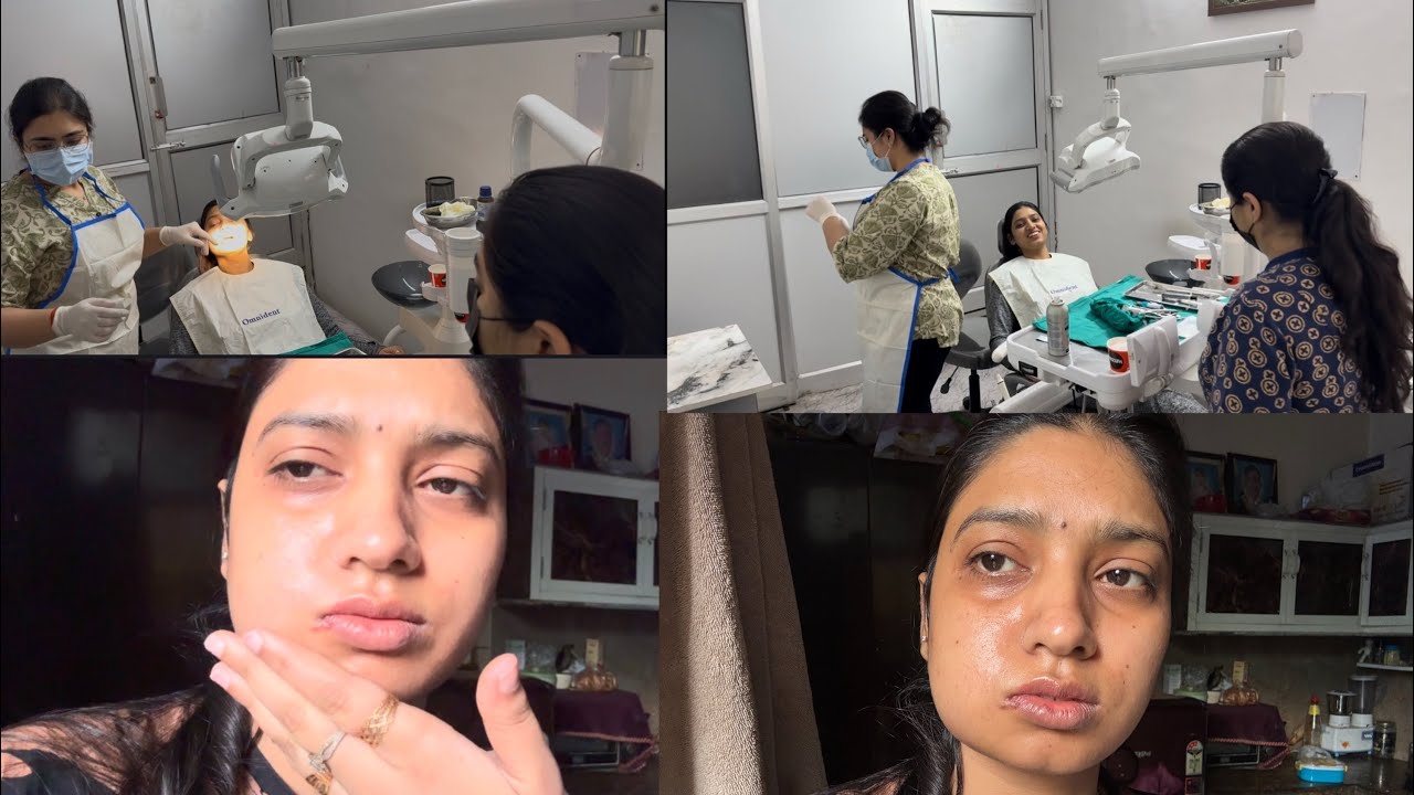 My wisdom tooth 🦷 removal surgery choti si surgery thi par bhoot painful hai 😭