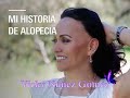 Mi historia de alopecia