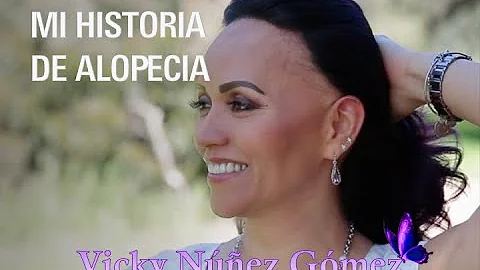 Mi Historia de Alopecia