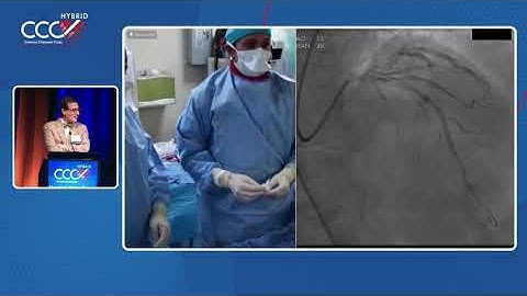 Live Case 7 - LAD CTO Bifurcation