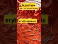 rbc || red blood cells || erythropoiesis ||  #shorts #biology #medical