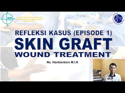 Perawatan Luka Skin Graft - Refleksi Kasus Episode 1