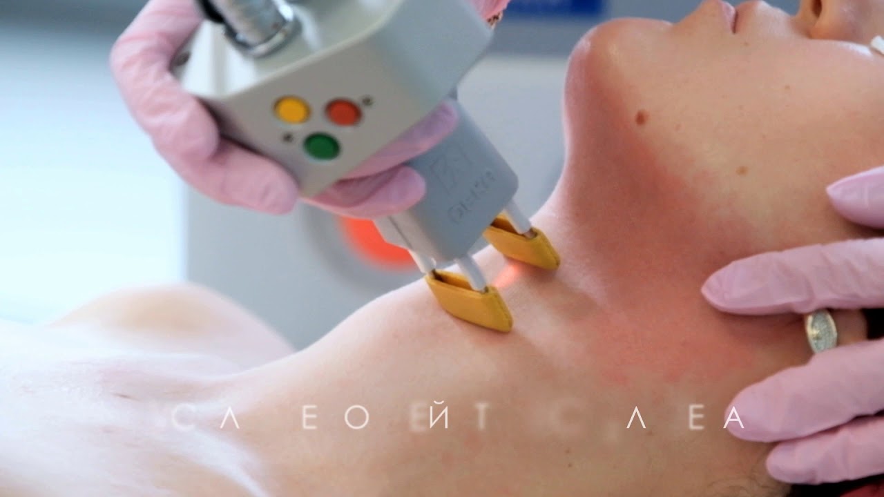 CO2 лазер SmartXide Touch в Клинике на Короленко